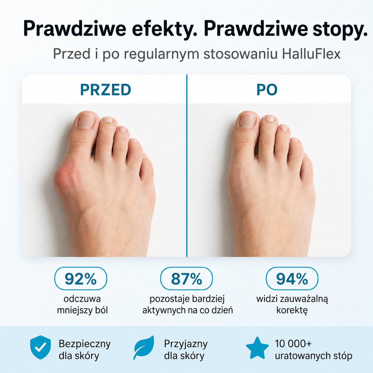 HalluFlex – Palec powinien powrócić do swojej normalnej pozycji. - obrazek 8